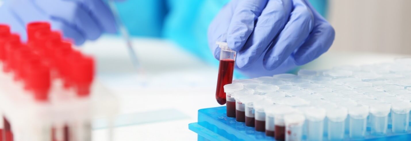 Lab Tests